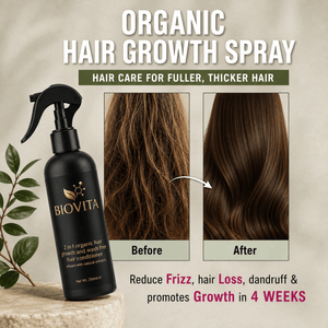 Hair Growth Spray for Hair Loss | Biovita Organic Leave-in Spray – (250ml) - Biovita